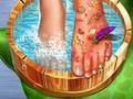 Gioco Medico della pelle dei piedi  in linea