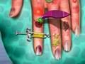 Gioco Medico della pelle delle mani  in linea