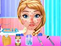 Gioco Trattamento allergia primaverile Anna  in linea