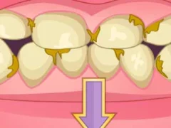 Gioco Bad Teeth Makeover in linea