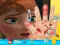 Gioco Anna hand doctor in linea