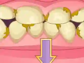 Gioco Bad Teeth Makeover in linea