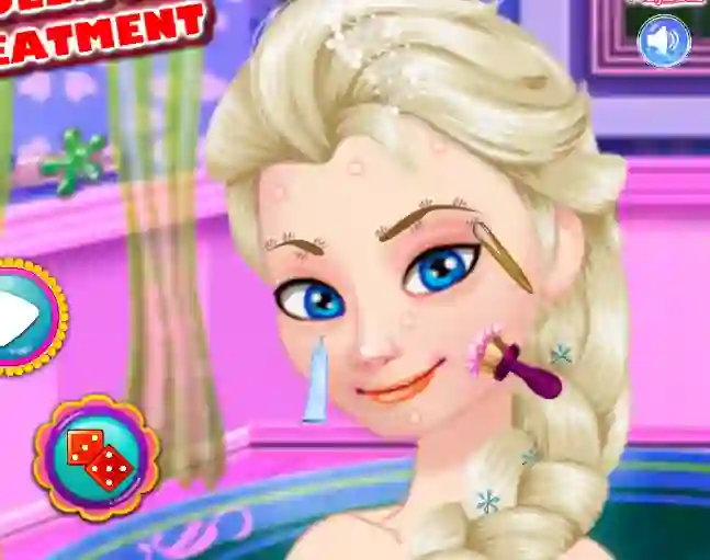 Gioco Ice Queen Acne Treatment in linea