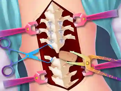 Gioco Anna Scoliosis Surgery in linea