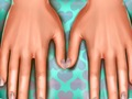 Gioco Dottore della pelle: Mani  in linea