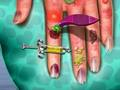 Gioco Medico della pelle delle mani  in linea